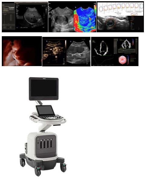 飛利浦Affiniti70 全身應(yīng)用超聲診斷系統(tǒng)